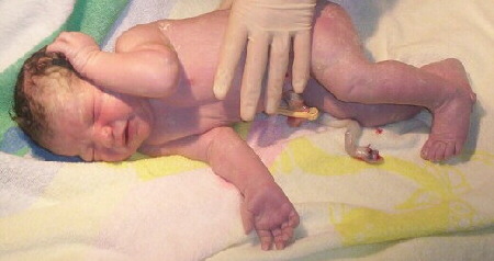 Ein Baby direkt nach der Geburt